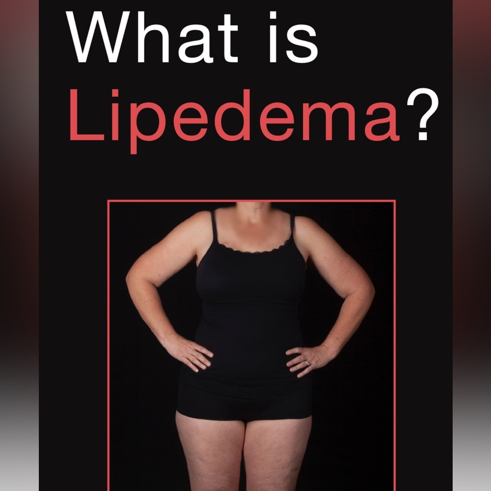 Did you know about Lipedema?